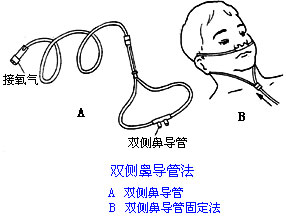 ◆肺病患者如何家庭氧療？